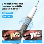 Pet Dental Scaler for Dogs & Cats, Ultrasonic Tooth Cleaner
